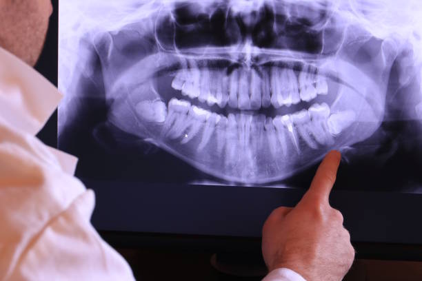 Best Broken or Chipped Tooth Repair in Thermal, CA